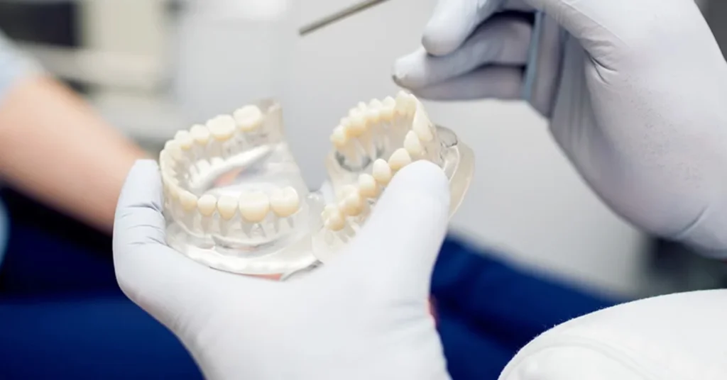 zirconia crowns 01